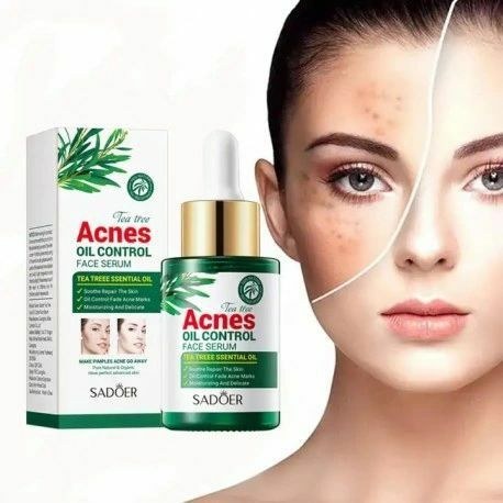 سرم صورت ضد جوش و آکنه تی تری سادور کد SD50606