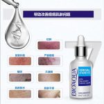 تاثیر سرم ضد جوش اورژانسی روی پوست